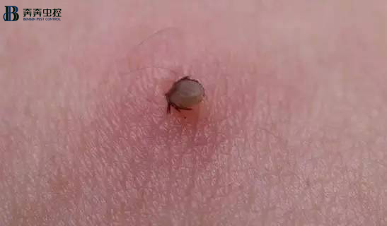 解讀蜱蟲預防與處理，值得收藏！