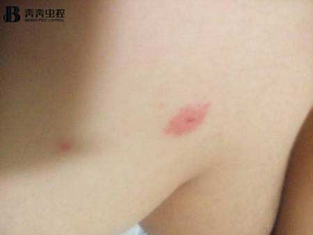 對(duì)抗蚊子塊的&ldquo;終極武器&rdquo;究竟是什么？