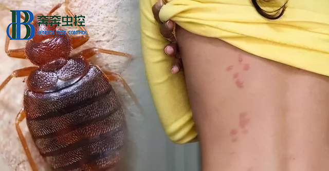 宿舍里有臭蟲(chóng)有什么辦法！怎樣把它們徹底消滅？  